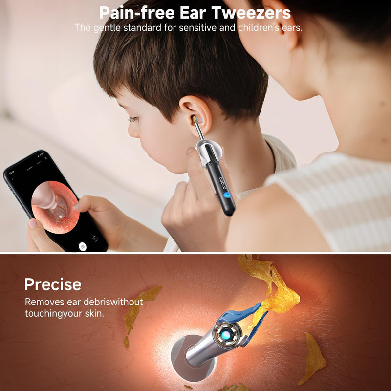 [Australia] - BEBIRD R1 Ultra Ear Wax Removal, Ear Cleaner with Camera Ear Scope, Wax Remove Ear Pick with Ear Otoscope Tweezers, Visual Dropper Cleaning Kit, Ear/Nose/Throat Examination Tool for Family 