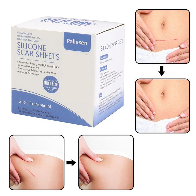 [Australia] - Silicone Scar Sheets, Silicone Scar Tape, Transparent 1.6”X 60”,Silicone Tape For Scars,Scar Sheets For Surgical Scars,For C-Section, Tummy Tuck, Acne Scar Treatment, Keloid Scar Remova 