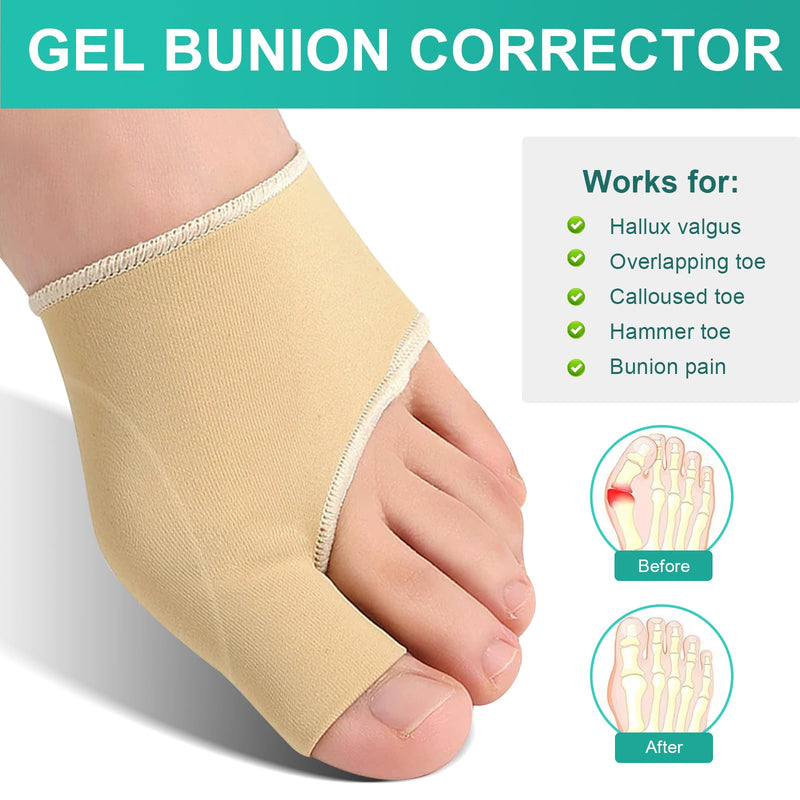 [Australia] - TCASENER 1 pair of hallux valgus socks, hallux valgus bandage for men and women, hallux valgus correction bandage, toe spreader big toe, protection of the ball of the toe 