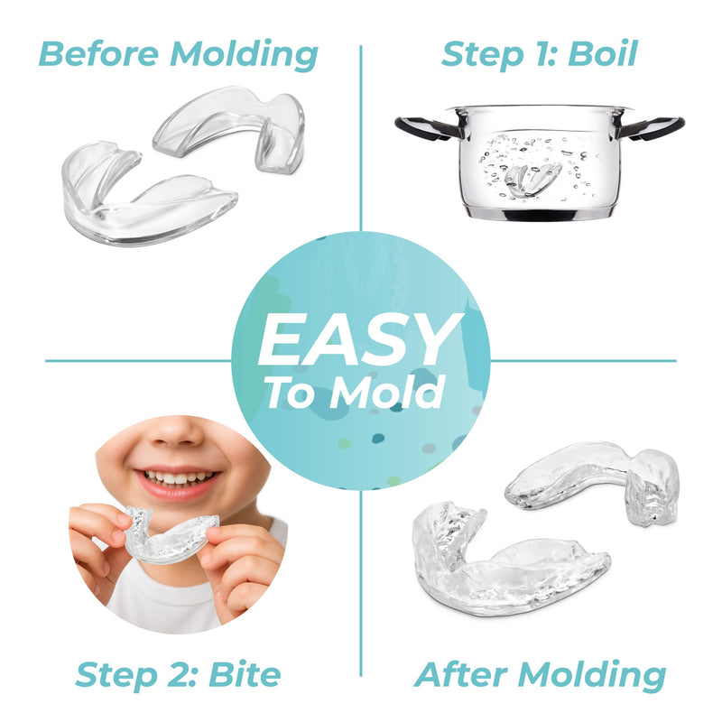 6-Pack Moldable Mouth Guards for Teeth Grinding and Clenching – Reusable, Trimmable Custom Fit Anti-Grinding Guards – 2 Sizes (4 Small + 2 Regular) for Small Mouths