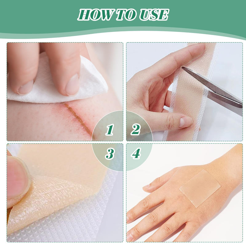 [Australia] - Silicone Scar Tape, silicone plaster for scars, silicone scar plaster, silicone scar plaster, silicone scar sheets, scar tape, silicone scar plaster, for all skin types (4 cm x 1.5 m). 