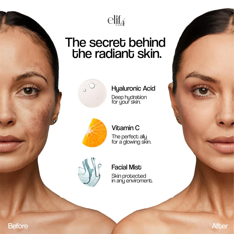 Repairing Hyaluronic Acid Serum – Deep Hydration & Anti-Aging Face Serum – Multi-Molecular HA, sensitive skin, rosacea skin, Boosts Elasticity – 30ml – Oil-Free, Vegan, Made in USA