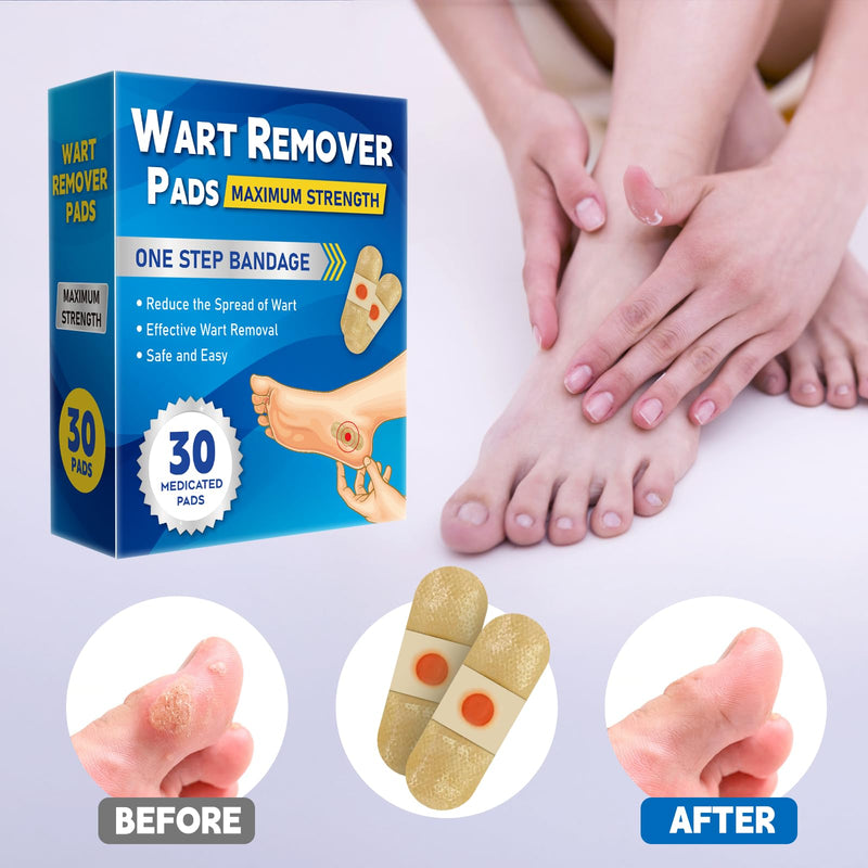 [Australia] - WABRINY Wart Remover Pads, Maximum Strength One Step Bandages for Hands Neck Feet Fingers, 30 Treatments-RK 30 Count (Pack of 1) 