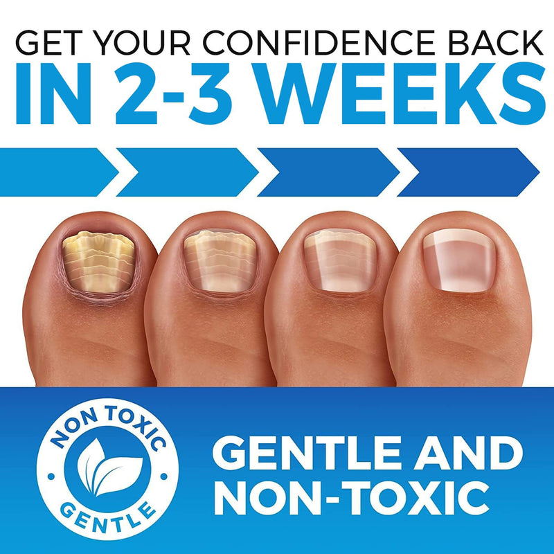 Toenail Fungus Treatment Extra Strength (FDA REGISTERED) - Fungi Nail Fungus Cream - XL - Nail Strengthener and Growth Improved Formula (Made in USA) 2.54 Fl oz 2.54 Fl Oz (Pack of 1)