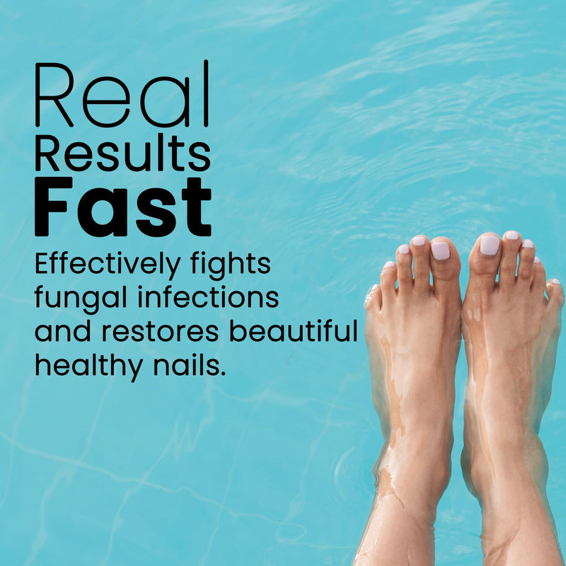 Dr. Canuso Antifungal Nail Treatment, Medical Strength Nail Oil, Nourishing Repair for Damaged Nails with Tolnaftate 1% Solution