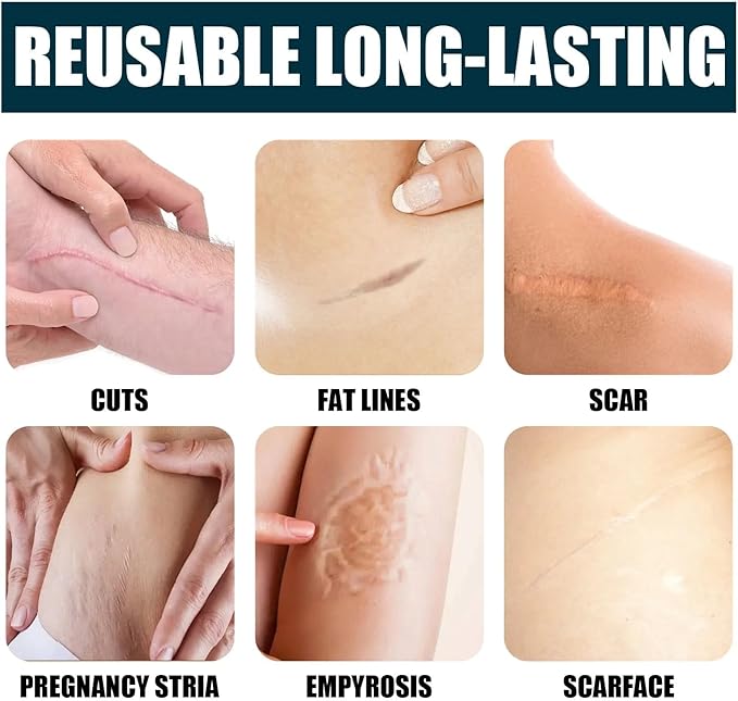Silicone Scar Cream Scar Gel - Advanced Scar Gel Scar Treatment for Stretch Marks Removal, Old & New Scars, Surgical Scars, Burns, Acne, C-Section, Keloid Scar Treatment for Women & Men, 1.76Oz