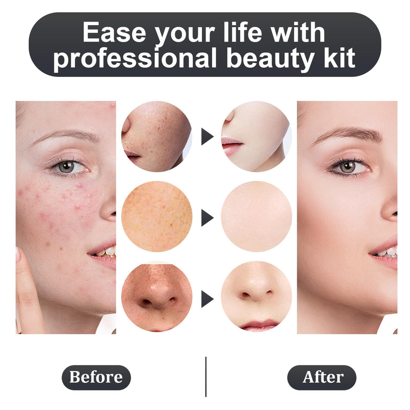 Stainless Steel Blackhead and Acne Removal and Extraction Tool Set, Quickly and Safely Remove Acne, blackheads, pimples, Blemishes, Whiteheads, Comes with Alcohol Tablets and Magnifying Glasses Silver 1 Count (Pack of 7)