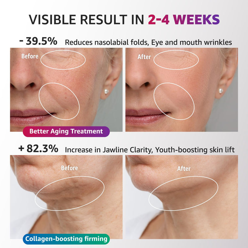 [Australia] - Red Light Therapy for Face and Neck, Renewal Face Lift Device with Vibration Tech, 3 in 1 Face Massager Tool with Thermals, True Beauty Glow Facial Sculptor for Wrinkles, Double Chin (White) 