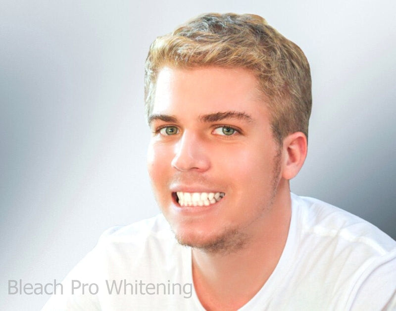 [Australia] - Teeth Whitening Gel Syringe 10ml Dispensers 44% Carbamide Peroxide Tooth Bleaching 4 Pcs 