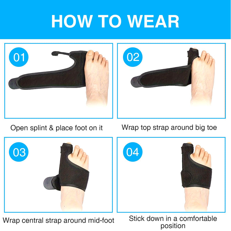 [Australia] - Katyjun 2x Hallux Valgus correction splint with 2x toe separators, bunion corrector 