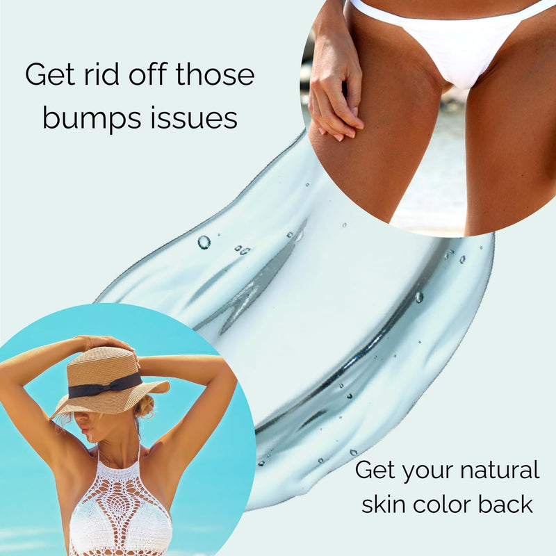 HelloRose Smoothing Solution Ingrown Hair Treatment (Made in USA) - Razor Bumps Treatment for Women & Men, Ingrown Hair Serum to Soothe Redness & Razor Burn in Bikini line, Legs and Underarms