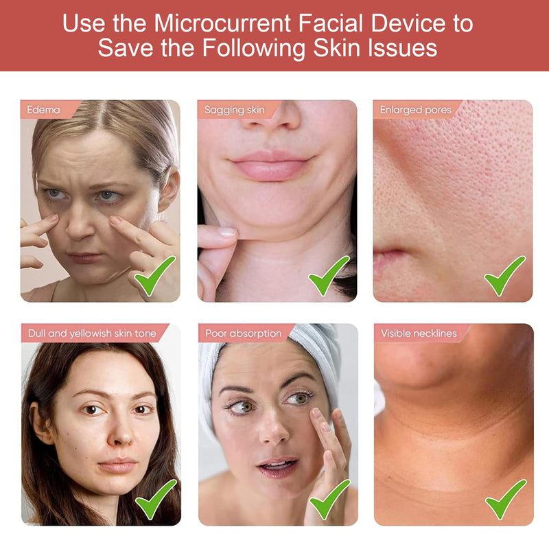 Microcurrent Facial Device - Electric Face Lifting & Toning for Face & Neck for Mother & Companion - Handheld Skin Care Device (White) White2