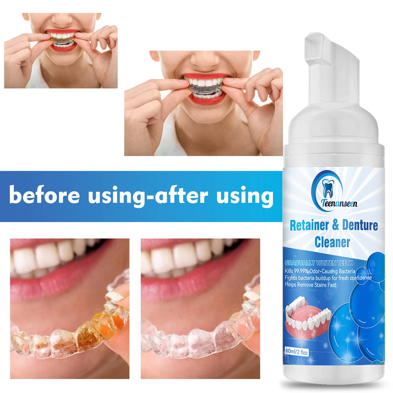 [Australia] - Aligner Cleaner, Denture Cleaner and Whitener Paste Foam Perfect for Sports Mouth Guard and Denture, Fast-Acting Alternative to Retainer Cleaner Tablets, Whitens Teeth and Fights Bad Breath 2 Pack 2 Fl Oz (Pack of 2) 