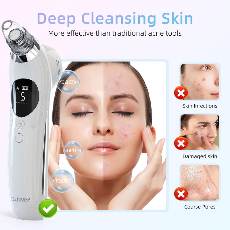 Blackhead Remover Vacuum Facial Pore Cleaner Electric Comedone Whitehead Extractor 5 Suction Probes and 5 Suction Levels Rechargeable Black Heads Remover Tools for Women & Men Facial Skin Care (white)