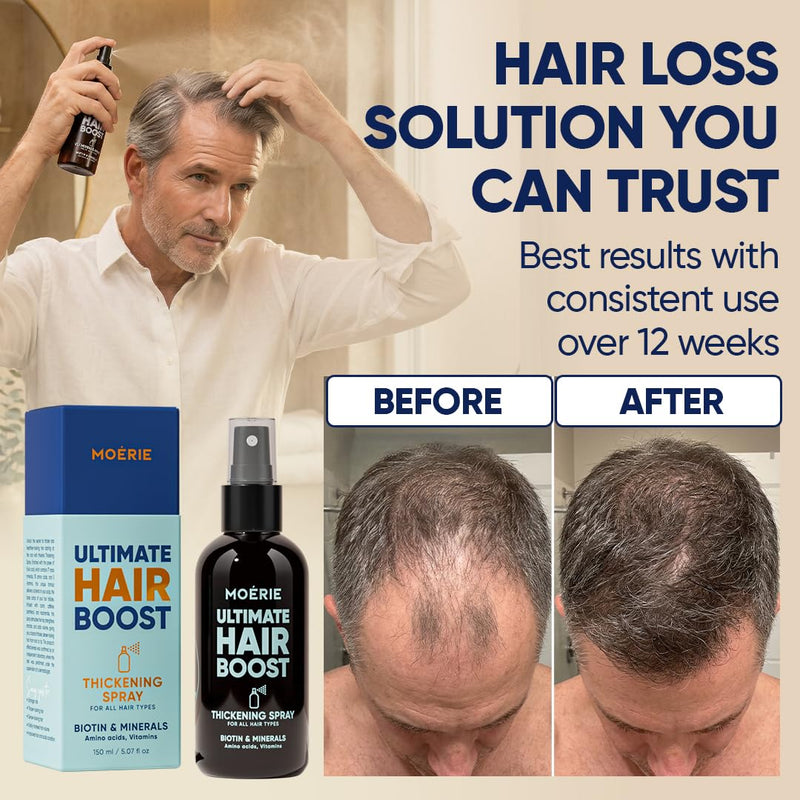 Moerie Hair Growth Serum Spray for Men and Women, Hair Loss Solution with Biotin and Rosemary, Thickening Serum for Hair Regrowth and Thinning Hair - Ultimate Scalp and Growth Care Single Set