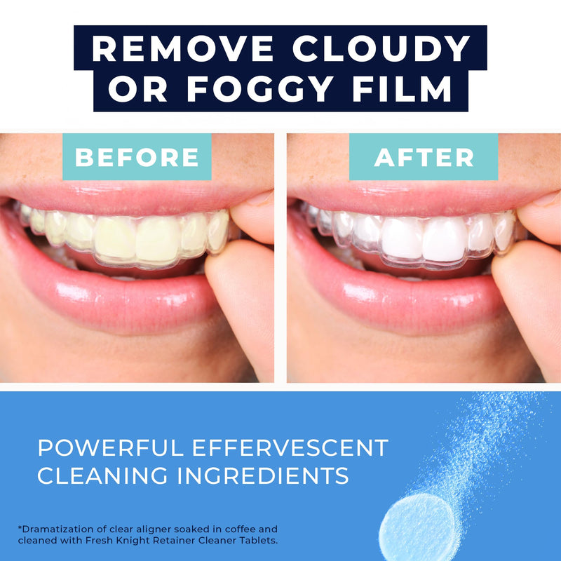 [Australia] - Retainer Cleaner Tablets 120 - Invisalign Cleaner - Denture Cleaner. Efferdent Retainer Cleaner Tablets, Night Guard, Mouth Guards, Aligners & Dental Appliance Cleaner - 4 Month Supply. 