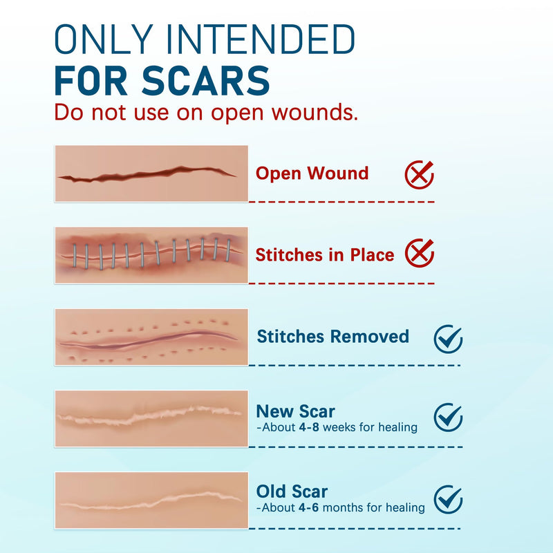 [Australia] - Silicone Scar Sheets, Large 10Pcs 4‚Äù x 7‚Äù Each, Medical Silicone Tape for Scar Treatment, Scar Patches for C-Section, Keloid Bump, Stretch Marks, Burn, Acne, Surgical Scar Removal 10 Sheets (each 4‚Äùx7‚Äù) 