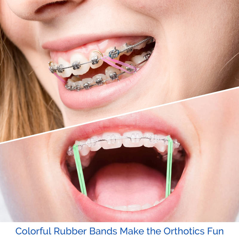 [Australia] - JMU Orthodontic Rubber Bands 1/4 Medium 6.4 mm Clear Orthodontic Elastics 4.5oz 500 pack Latex Free Dental Rubber Bands Made in USA 