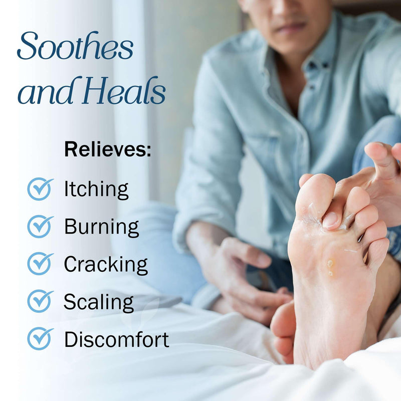 [Australia] - Miconazole Antifungal Cream for Skin - 4 oz of Miconazole Nitrate for Jock Itch, Athlete's Foot, Itching, and Ringworm 1 Pack 