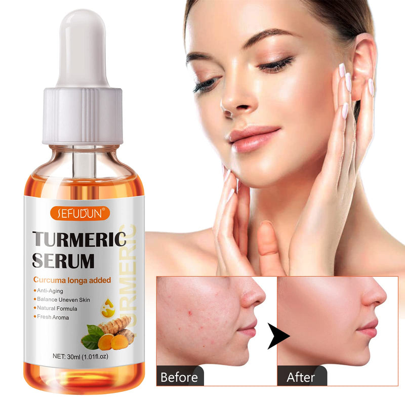 2 Pack Turmeric Serum for Dark Spots, Turmeric Dark Spot Corrector Serum for Acne, Hyperpigmentation and Smooth Skin, Formulated with Hyaluronic Acid, Vitamin C & E - 1.01 FL.OZ 1.01 Fl Oz (Pack of 1)