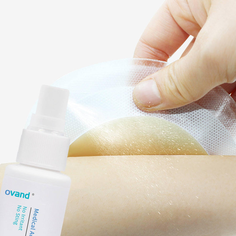 [Australia] - Medical Adhesive Remover Spray - 1 oz.No-Sting Ostomy Adhesive Remover Spray : Adhesive Remover for Skin,Ostomy,Mastectomy,Adhesive Tape 1 Bottles 