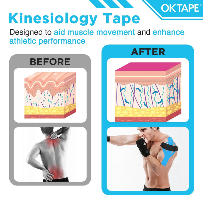 [Australia] - OK TAPE 100Pcs Precut Kinesiology Tape Strips, Elastic Athletic Tape for Joints Support & Muscle Pain Relief, Waterproof, Kinetic Tape for Shoulder, Knee, Ankle (5 Colors, 2 inch x 10 inch) Mixed 100 Pcs 