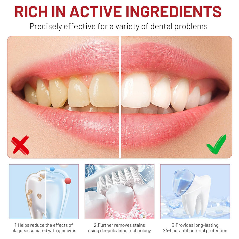 [Australia] - Sp10 Probiotic Toothpaste, Sp-10 Ultra Whitening Toothpaste, Fresh Breath Stain Removal, Deep Cleaning Care(2pcs) 