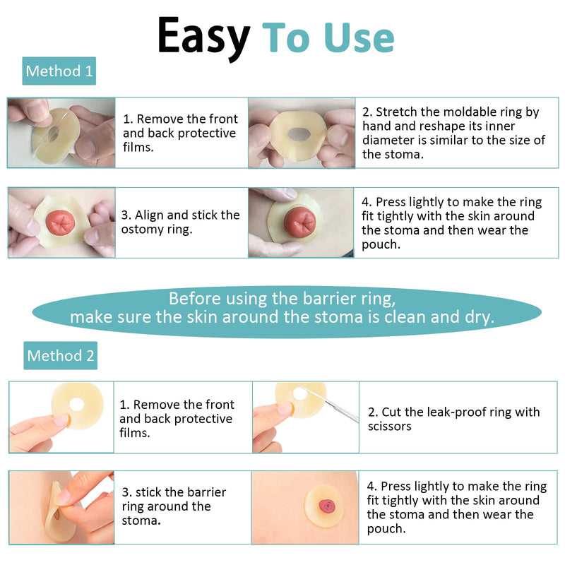 [Australia] - 20PCS Ostomy Barrier Rings, Medical Hydrocolloid Ostomy Supplies, Moldable Ostomy Ring, Leak-Free Skin Extender Rings, Stoma Protector Seal for Colostomy Bags 