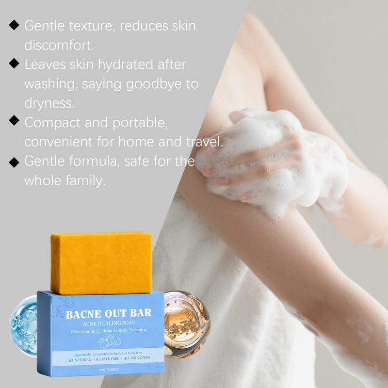 2 PCS Bacne Out Back Acne Cleansing Soap | Turmeric, Vitamin C & Alpha Arbutin Formula, Natural Exfoliating Cleanser For Back & Body Breakout Care