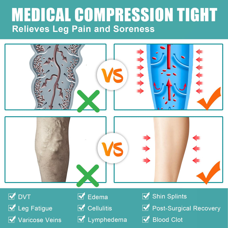 [Australia] - Evolyline Medical compression stockings for women and men, long 20-30 mmHg, class II graduated compression tights, support stockings, toe-free compression trousers for varicose veins, edema, black, XXL 