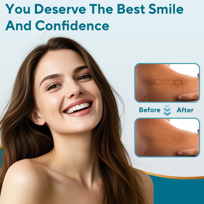 [Australia] - Silicone Scar Sheets, Silicone Scar Tape, Reusable Scar Silicone Strips for Scar Removal Treatment, Soft Silicone Scar Sheets for Surgical Scars, Keloid, C-Section, Burn et(1.6‚Äù x 59‚Äù Roll-1.5M) 1.5M 