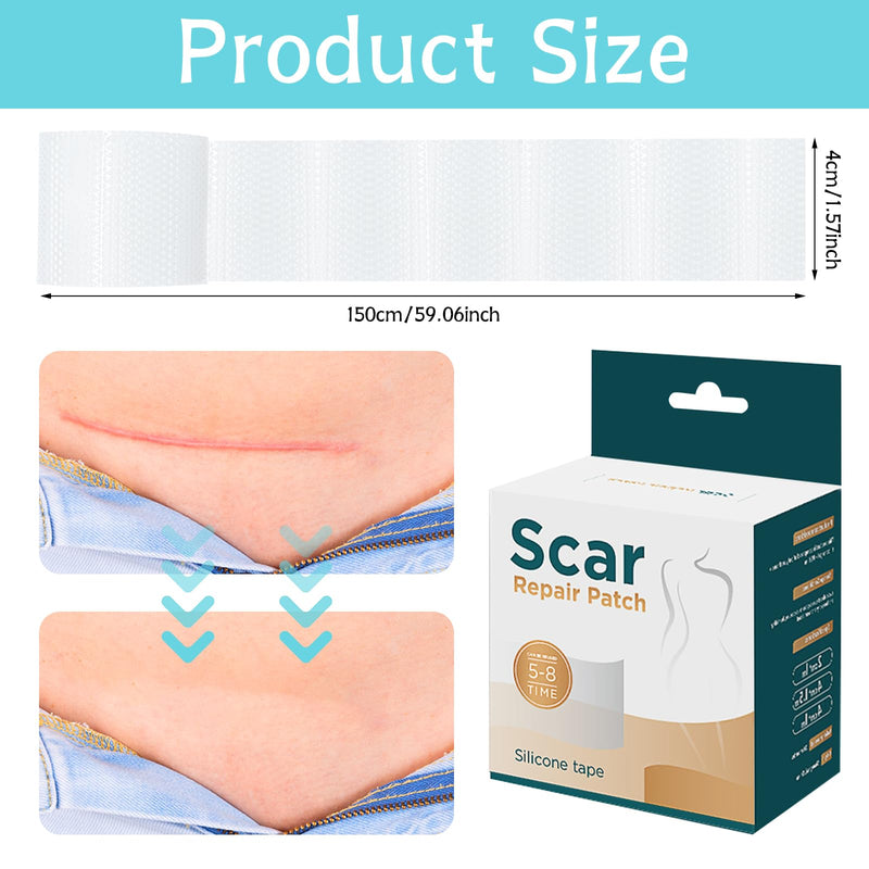 [Australia] - Volhuluk Transparent Silicone Scar Plaster (4x150cm), Silicone Plaster Professional for C-Section Scars, Operations, Burns, Keloid, Acne and More, Silicone Plaster for Scars 