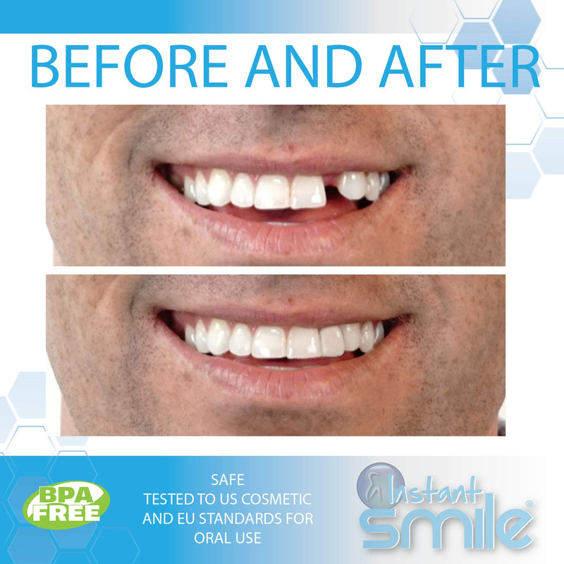 [Australia] - Instant Smile Themal Fitting Temporary Tooth Replacement Fitting Beads 