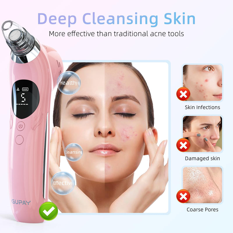 Blackhead Remover Vacuum Facial Pore Cleaner Electric Comedone Whitehead Extractor 5 Suction Probes and 5 Suction Levels Rechargeable Black Heads Remover Tools for Women & Men Facial Skin Care (Pink) Pink