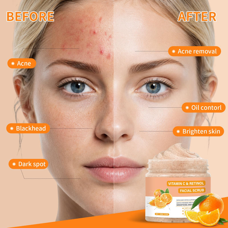 Vitamin C and Retinol Face Scrub, Facial Scrub Exfoliating Clears Blackheads, Improve Dark Spot and Acne 100g/3.5oz
