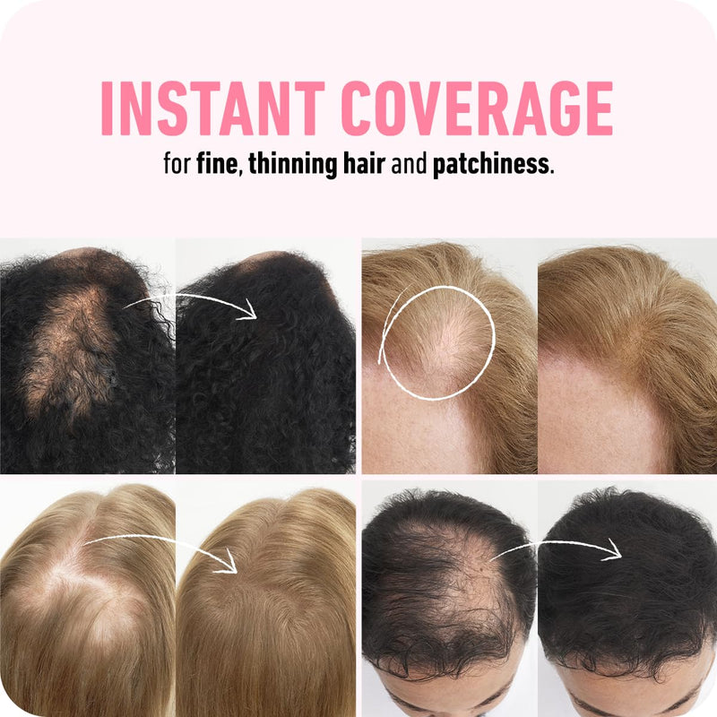 BOLDIFY Hair Fibers for Thinning Hair, for Women & Men, Dark Brown 28g | Instantly Fills Thinning & Fine Hair for a Fuller, Thicker Look - Thin Spot Cover Up - Hair Building Fibers & Hair Powder