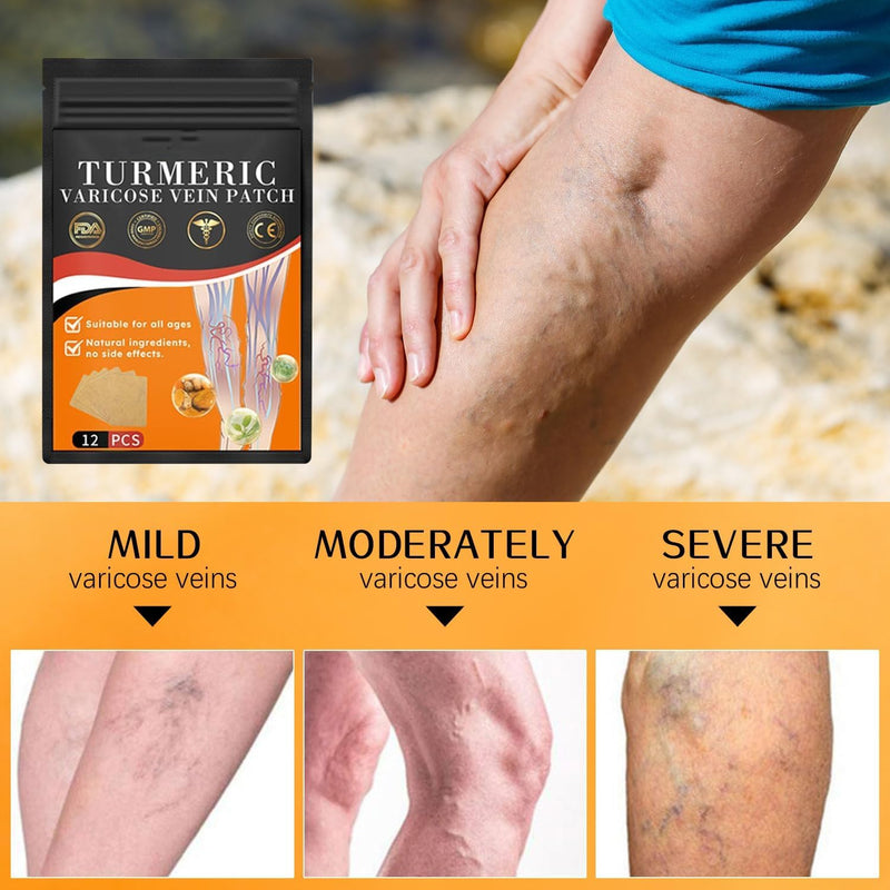 [Australia] - Furzero turmeric varicose vein plaster, Furzero varicose vein plaster, turmeric varicose vein plaster, turmeric plaster for varicose veins, promotes blood circulation (48 PIECES) 