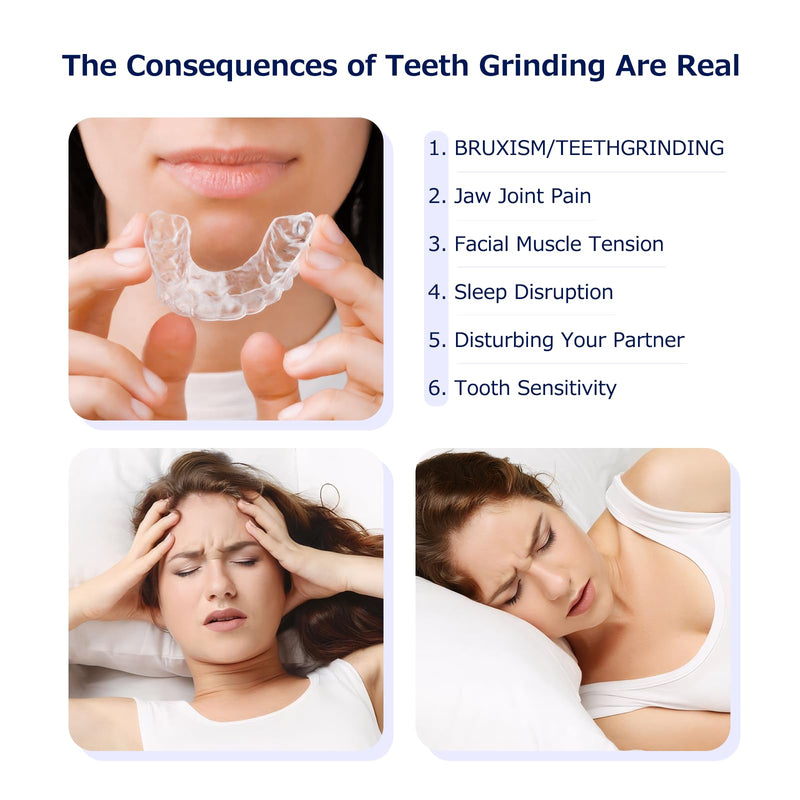 [Australia] - Custom Fit Night Guard for Bruxism & Teeth Clenching - Comfortable & BPA-Free - Protects Teeth & Reduces Jaw Tension - Includes Case & Easy-to-Use Mold Kit（Single One Upper or Lower Guard） 