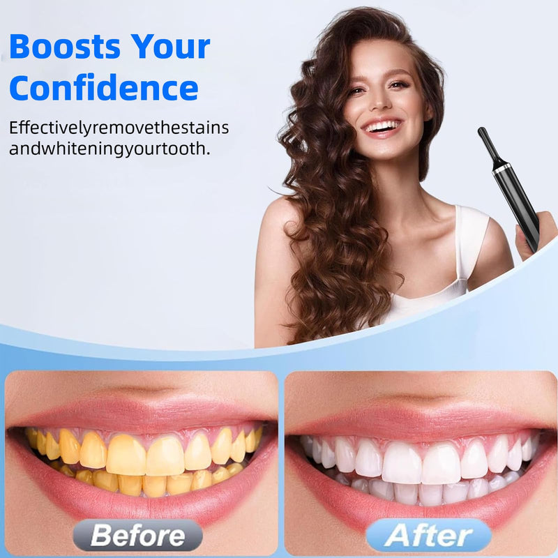 [Australia] - Teeth Polisher with 5 Brush Heads 8 Polish Pastes 5 Speed Modes and LED Light IPX6 Waterproof Tooth Polishing Kit Teeth Cleaner Tools for Home Use Teeth Whitening and Cleaning Style 2 