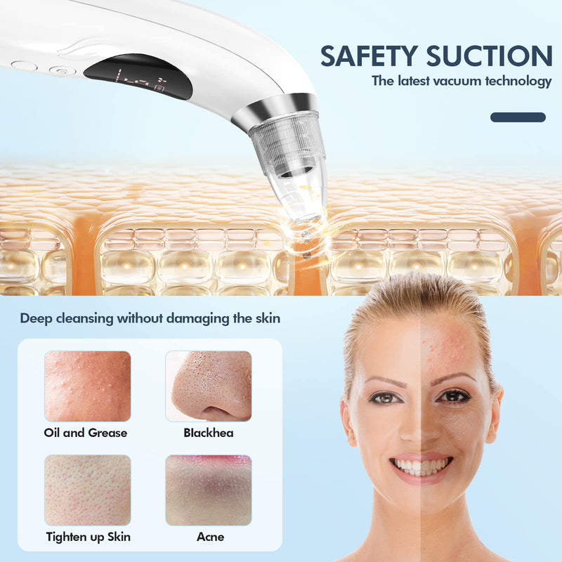 Blackhead Remover Pore Vacuum, Upgraded Black Head Remover for Face, Electric Acne Comedone Whitehead Extractor Tools-5 Suction Power, 5 Probes, USB Rechargeable Pimple Popper Tool Kit White