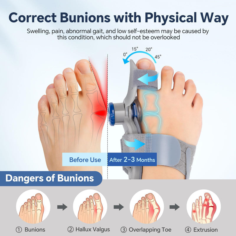 2 Pack Bunion Corrector for Men & Women, Adjustable Knob Toe Splint with Silicone Pads, Bunion Relief Brace with Dual Toe Straps, Night & Day Use, Fits Left & Right Foot DOUBLE