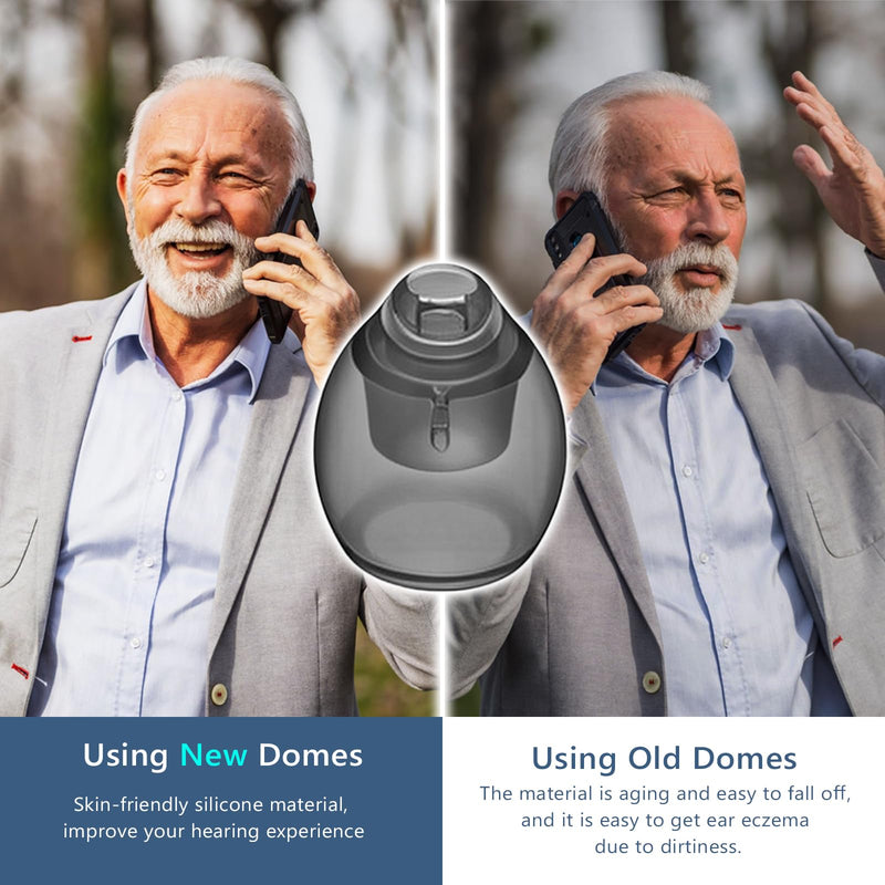 [Australia] - 20 pcs Phonak Vented 4.0 Hearing Aid Domes Small Size (0.29inch=7.5mm),Phonak Hearing aid Accessories,Hearing Aids Domes for Phonak Audeo Marvel Paradise Lumity Accessory Vented 4.0 Dome Small White-2 Pcaks/20 Pcs 