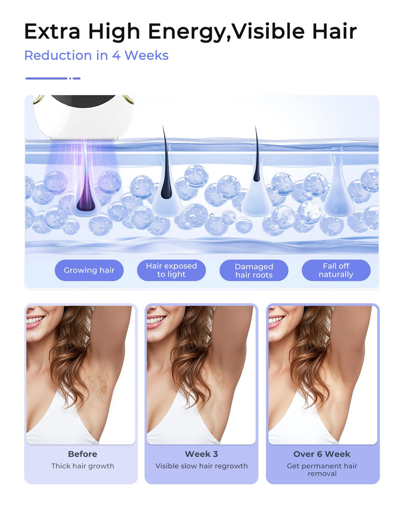 [Australia] - Laser Hair Removal for Women and Men, Air 15 Ice-cooling IPL Device Hair Removal for Nearly Painless & Long-Lasting Results From Home, 3 Modes & Auto Flashing for Fast Full Body Hair Removal 