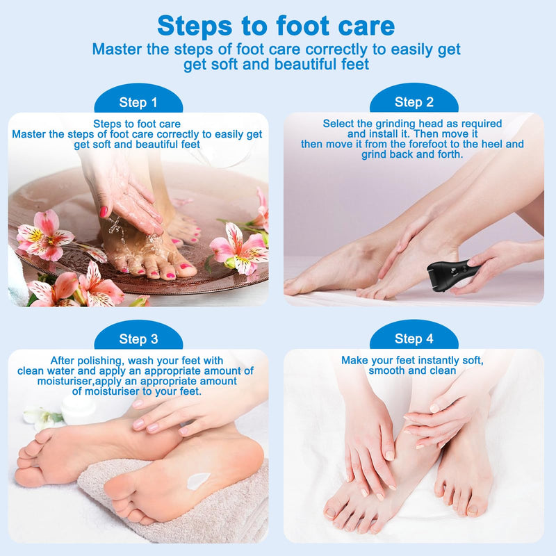 [Australia] - UCAMP electric callus remover with 3 replacement rollers, electric callus remover, waterproof callus rasp, callus removal foot, rechargeable, foot callus remover for foot care 