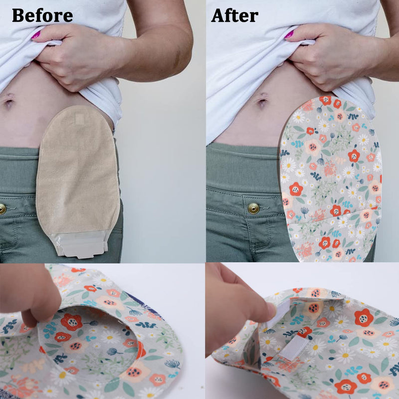 [Australia] - Ostomy Bag Covers - 3pcs Colostomy Bag Covers Odor Reducing Ostomy Pouch Covers, 3 inch Round Opening Colostomy Bag Covers For Men Or Women, Ileostomy, Washable 