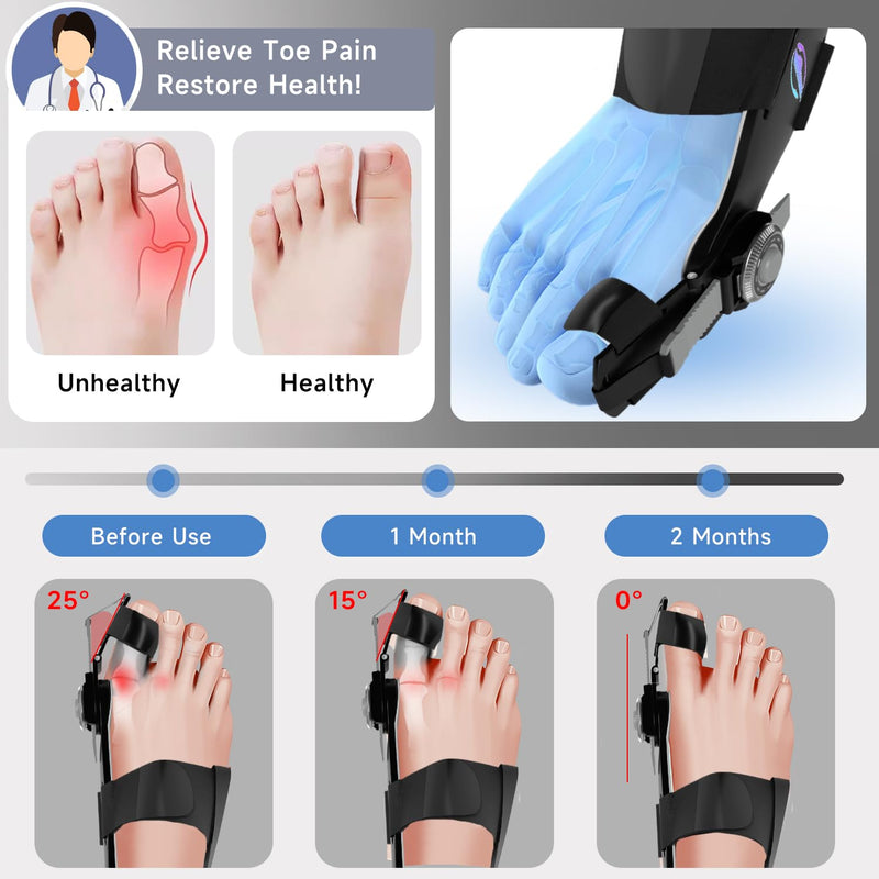 [Australia] - Bunion Corrector for Women & Men, Orthopedic Bunion Splint with Toe Separator Adjustable Toe Straightener Suitable for Left/Right Feet Hallux Valgus Relief(Black 1Pcs) Black 1 