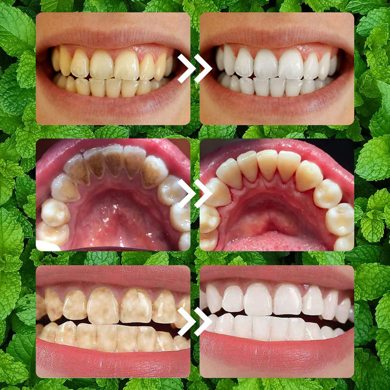 [Australia] - Teeth Restoration Mineral Powder, Mineral Tooth Powder, Tooth Restoration, Whitening Natural Teeth Restoration Powder, Effective in Strengthening Teeth and Gums, Protect Gums and Freshen Breath(2PCS) 1 Ounce (Pack of 2) 