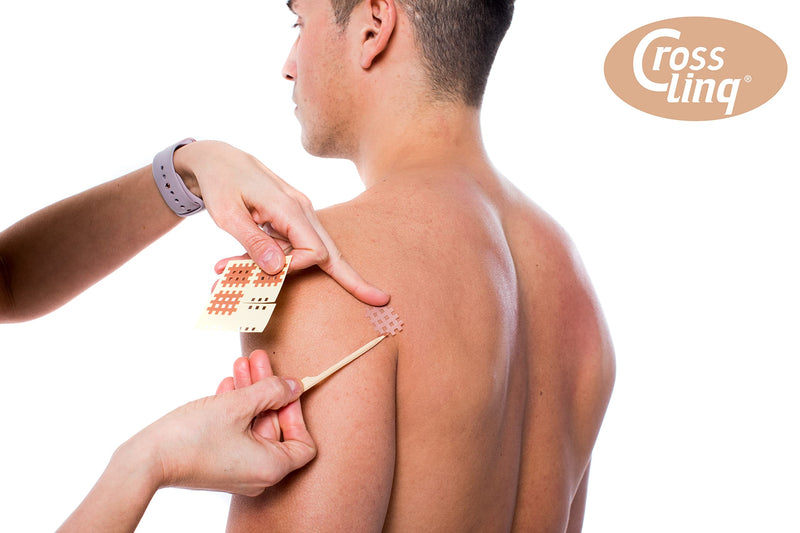 [Australia] - CrossLinq Acupressure Patches | Acupuncture Patch for Scars & Muscle Pain | Crosshatch Pain Patches | Non-Elastic Crosspatches | Small | (Pack of 240) 240 Small Patches 