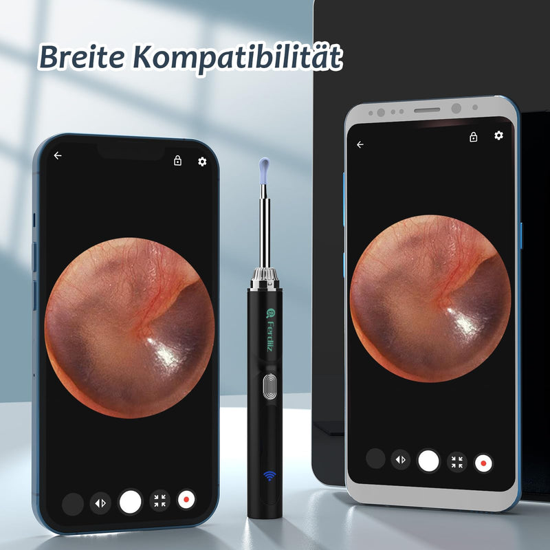 [Australia] - Earwax Remover Otoscope, Ferdiiz 1080P Ear Cleaner with Camera, IP67 Waterproof Ear Cleaning for iPhone, iPad and Android Smartphones.(Black) Black 1 