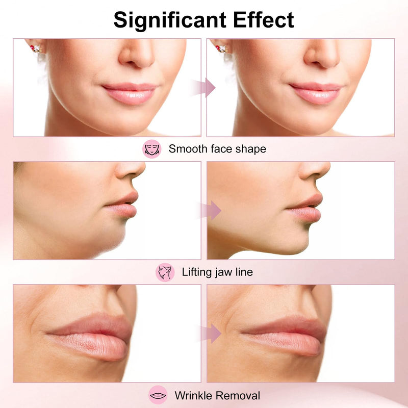 Multi-Functional Face Lifting Device, V Roller Face Lift, Tightening, Skin Care, Double-Sided Roller Design, Type-C Fast Charging, Portable Beauty Device with 3 Adjustable Settings (White)